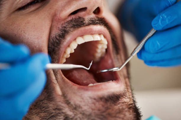 Emergency Dental Services in Scotts Hill, TN